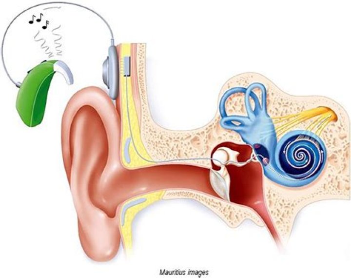 Unveiling The Journey Of Abigail Bachelor And Her Cochlear Implant Experience