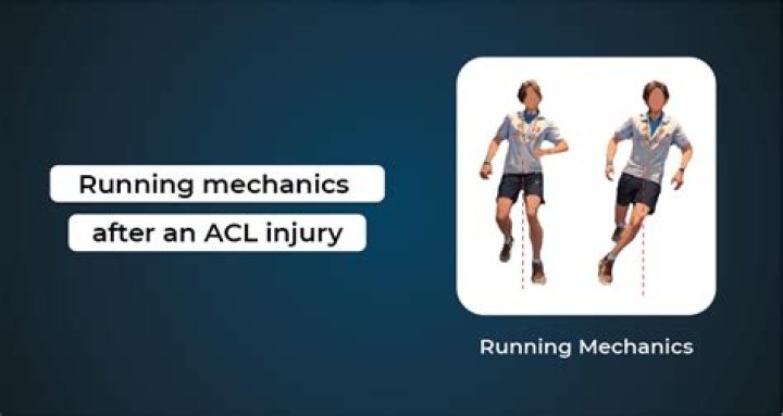 The Ultimate Guide To ACL Injury Prevention For Runners: Everything You Need To Know