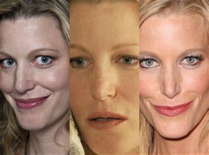 Unveiling The Transformation Of Anna Gunn's Nose: A Journey Through Beauty Standards