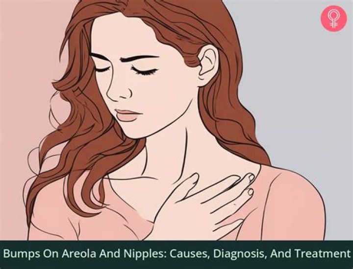 Are Nipple Bumps Normal or Something to Worry About?