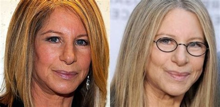 Barbra Streisand's Journey: The Facelift That Sparked Conversations