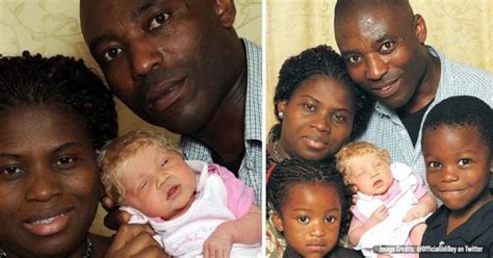 Black couple gives birth to blonde, blue-eyed child who they call “a miracle baby”