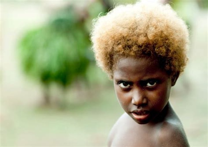 Exploring The Phenomenon Of Black Individuals With Blond Hair