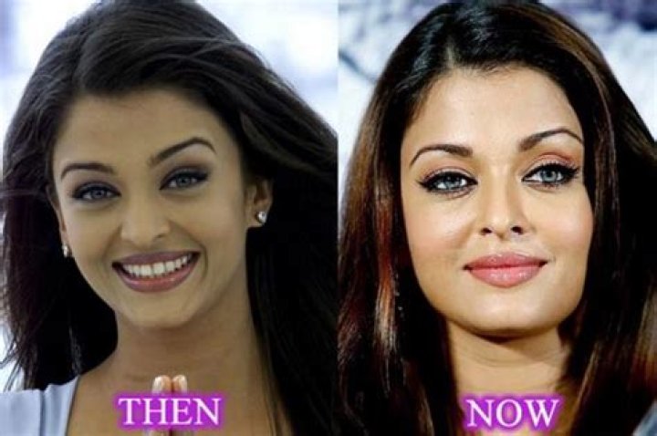 Transformations Of Glamour: The Intriguing World Of Bollywood Cosmetic Surgery