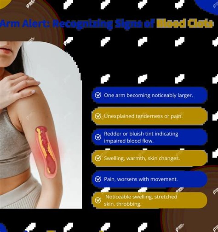 Quick Answer: Can Blood Draw In Arm Cause Shoulder Pain