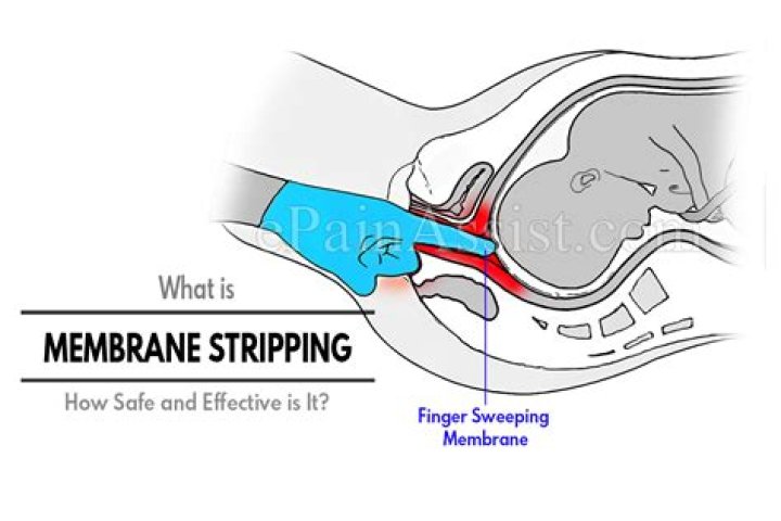 Question: Can You Diy Membrane Sweep