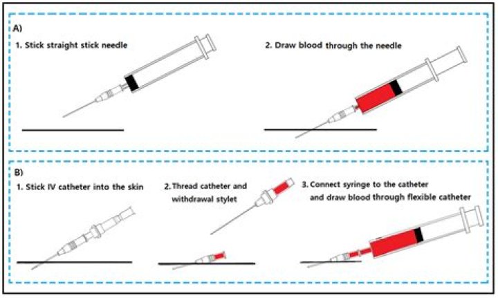 Can You Weight Lift After Blood Draw