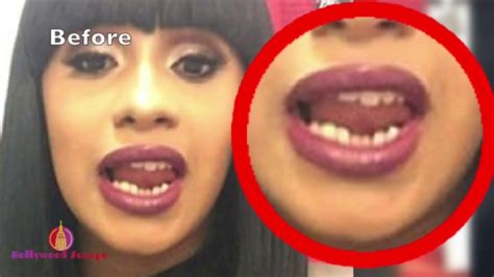 Transformations And Triumphs: Cardi B Before She Fixed Her Teeth