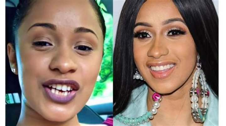 Cardi B's Teeth: The Iconic Smile Behind The Superstar