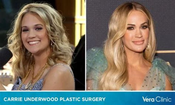Carrie Underwood: The Truth Behind Plastic Surgery Rumors