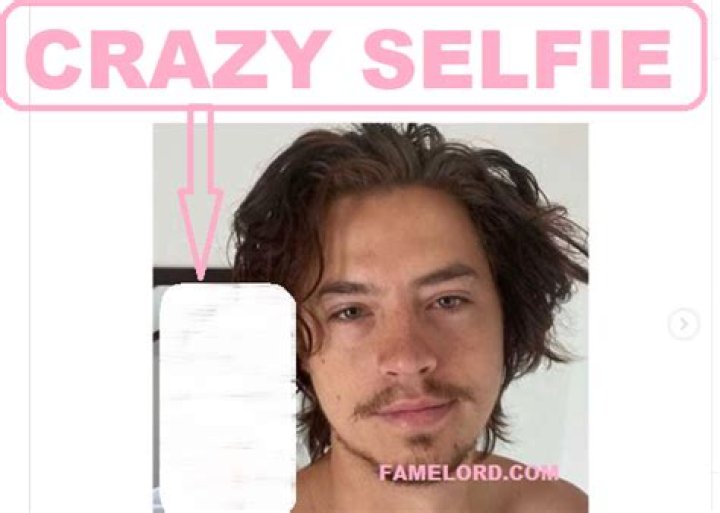 Cole Sprouse BBL: Unraveling The Mystery Behind The Trend