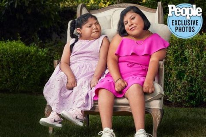 Conjoined Twins Maria And Teresa: An Inspiring Journey Today