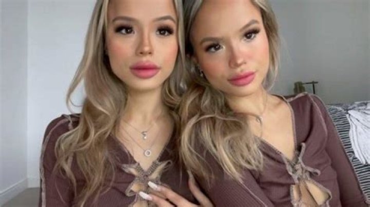 Exploring The Fascinating Lives Of The Connel Twins