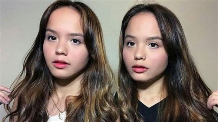 The Fascinating World Of The Connell Twins: A Deep Dive