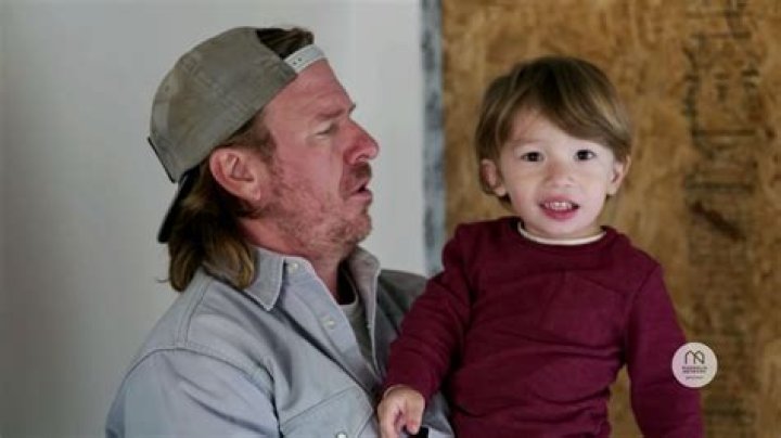 Crew Gaines Syndrome: Understanding A Rare Condition