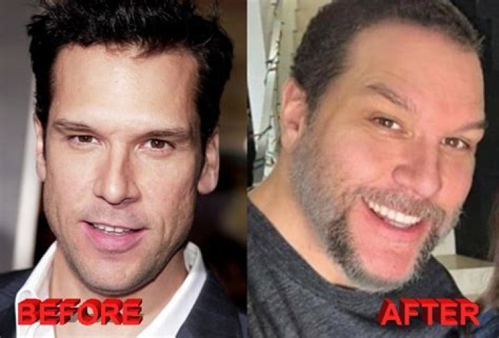Dane Cook: The Transformation And Speculations Surrounding His Plastic Surgery Journey