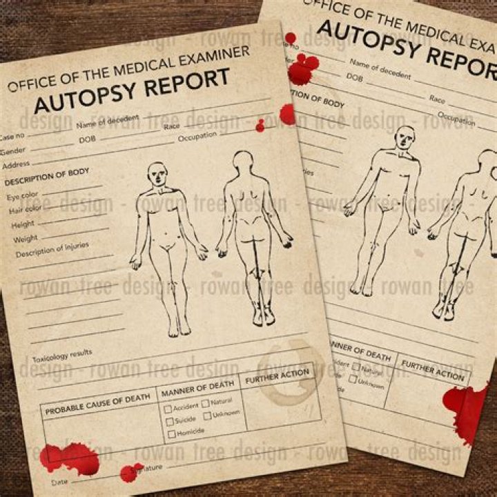 Unveiling The Truth: The Deedee Autopsy Report