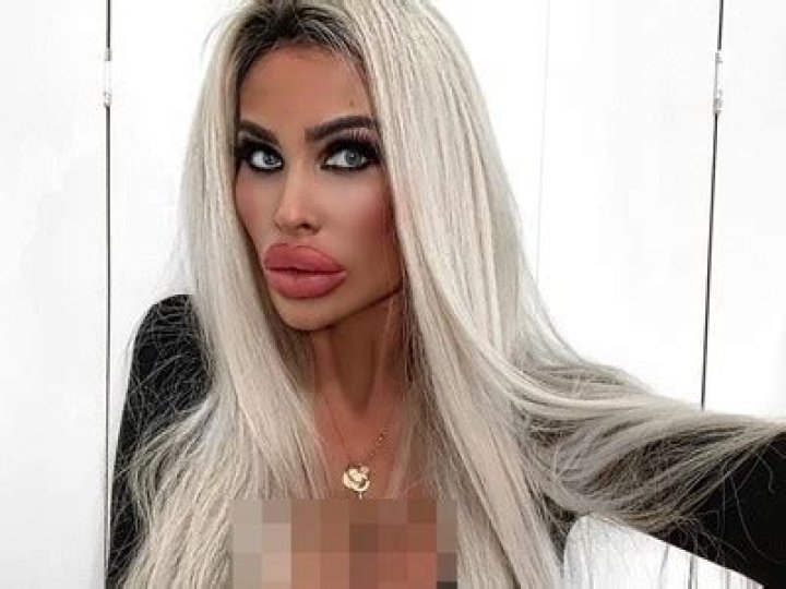 Despite warnings from doctors, a plastic surgery addict says her over-the-top look is still not enough