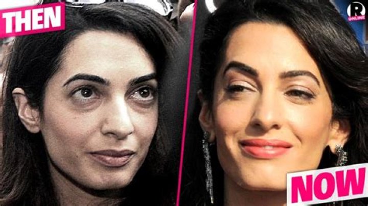 Did Amal Clooney Have A Nose Job? Unraveling The Truth Behind The Speculations