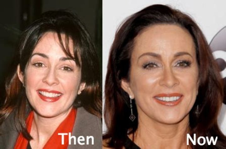 Unveiling The Truth: Did Patricia Heaton Have Plastic Surgery?