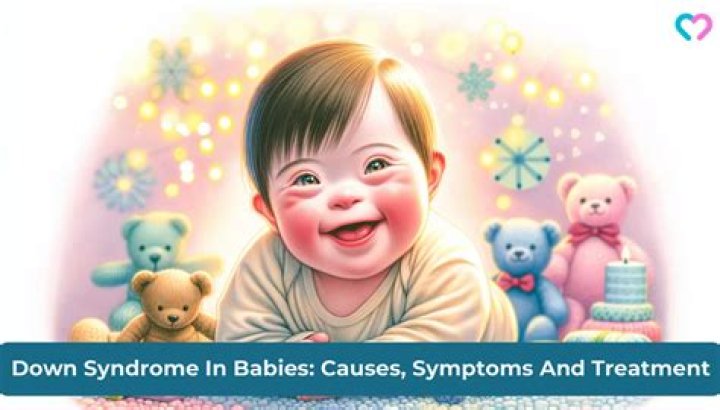 Unraveling The Mystery: Does Baby Crew Have Down Syndrome In Real Life?