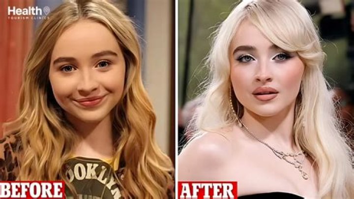 Does Sabrina Carpenter Have Filler? Exploring The Truth Behind The Rumors