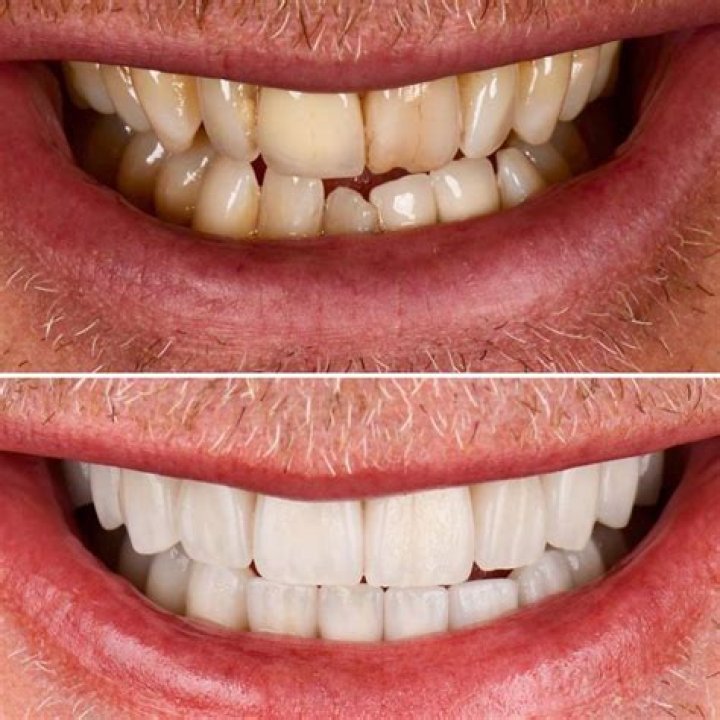 Unveiling The Secrets Behind Dorit Kemsley’s Dazzling Smile