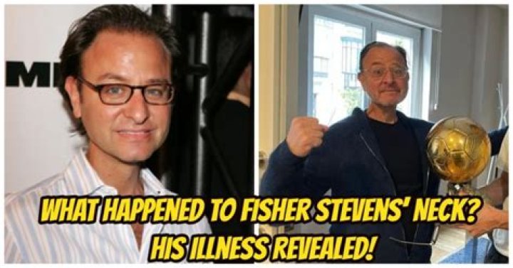 Fisher Stevens Neck: Understanding The Condition And Its Impact