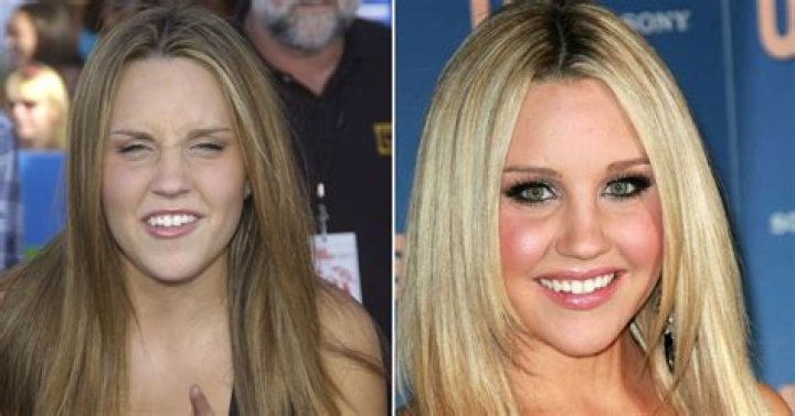 Former child star Amanda Bynes detained by police – evaluated for mental health amid current struggles