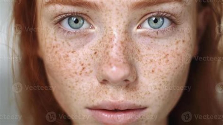 Beauty In Spots: Celebrating Freckle Faces