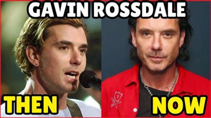 Exploring The Mystique Of Gavin Rossdale's Plastic Surgery Journey