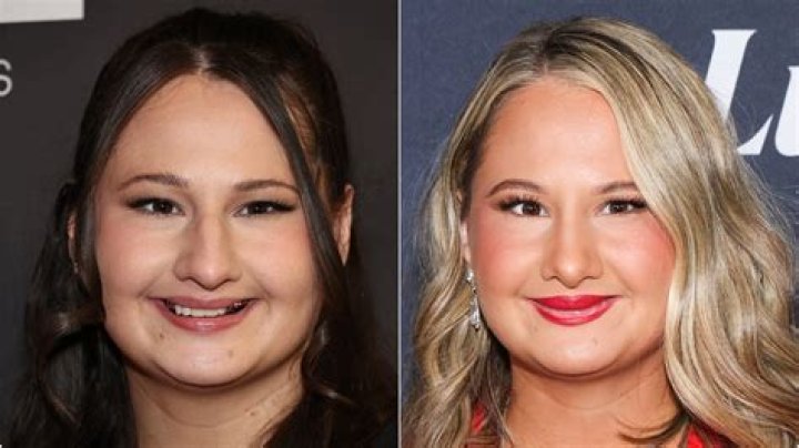 Unveiling The Transformation: Gipsy Rose Nose Job