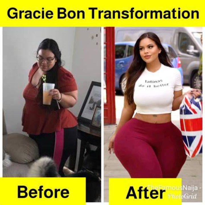 Gracie Bon Before Surgery: A Comprehensive Guide To Her Journey