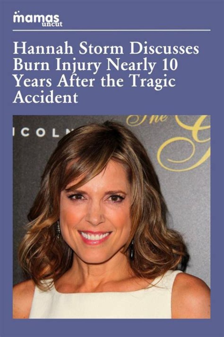 Hannah Storm: Triumph Over Adversity After Burn Injury