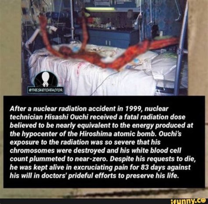 Hisashi Ouchi: The Tragic Story After Radiation Exposure