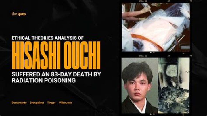 Understanding Hisashi Ouchi's Face: The Story Behind The Infamous Incident