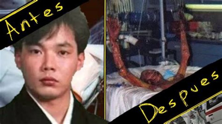 Hisashi Ouchi: The Tragic Story Behind The Radiation Pictures