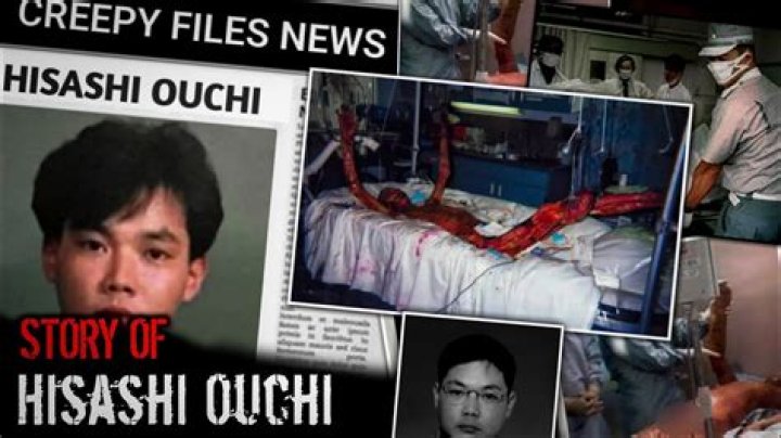 Hisashi Ouchi Real Photo: Understanding The Tragic Story Behind The Image