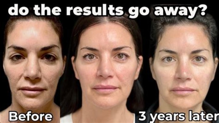 Quick Answer: How Long Does It Take To See Results From Aztec Clay Mask