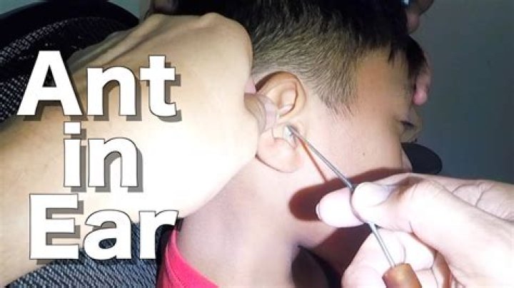 Quick Answer: How To Get Bug Out Of Ear