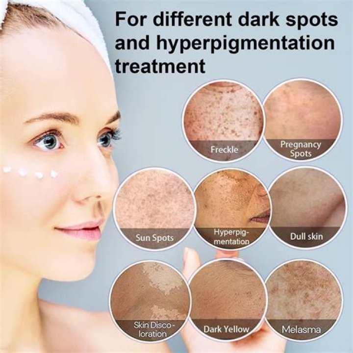 Question: How To Get Rid Of Age Spots With Hydrogen Peroxide