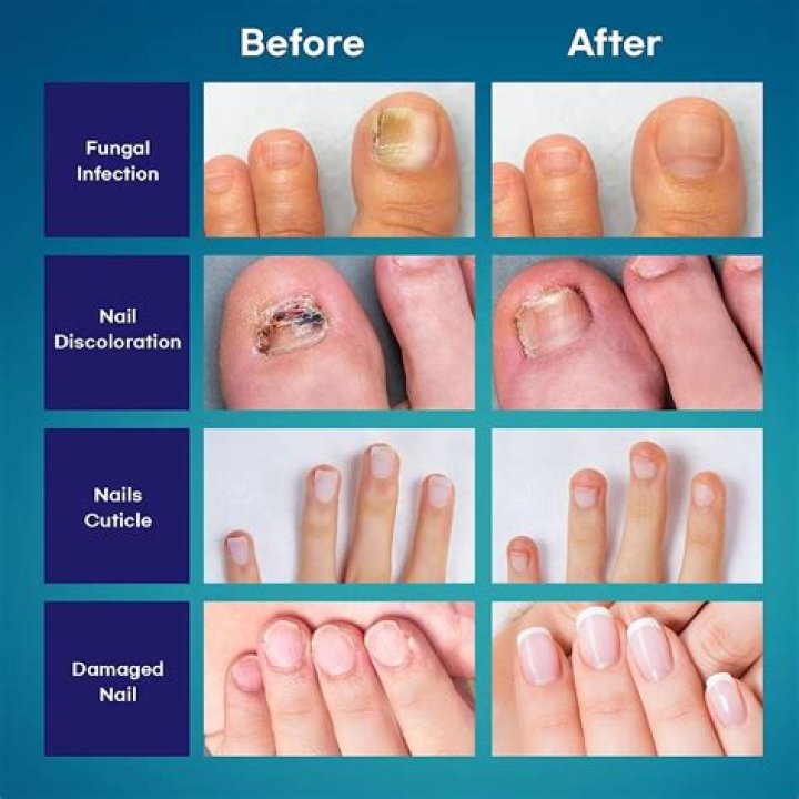 Question: How To Get Rid Of Nail Scratches On Skin