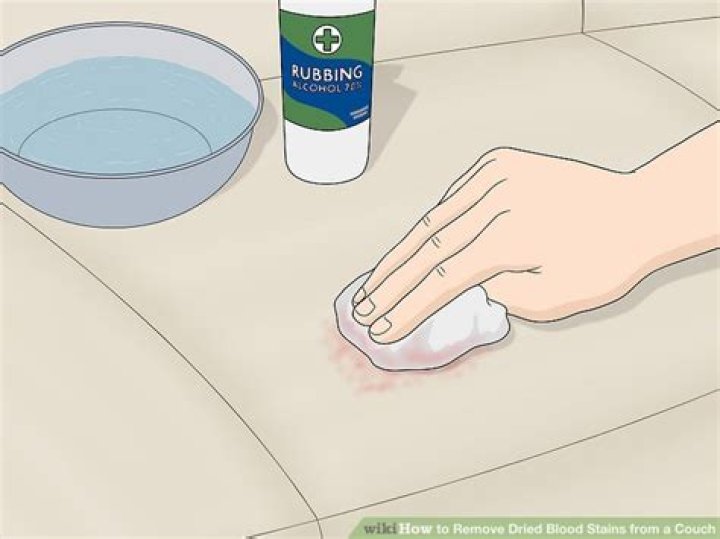 How To Remove Dry Blood From Skin