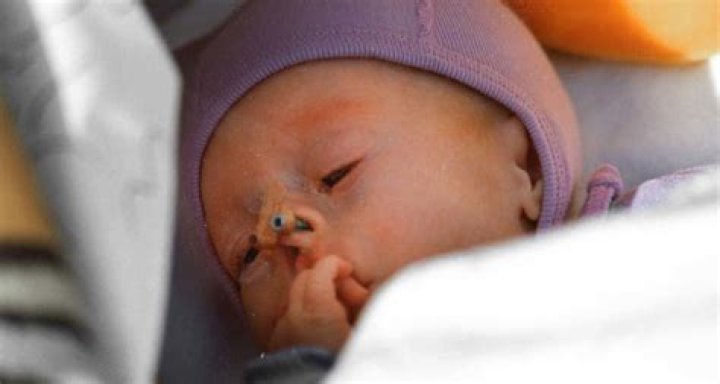 Ilka Brühl was born with rare facial defect – now she’s breaking beauty standards with her modeling career