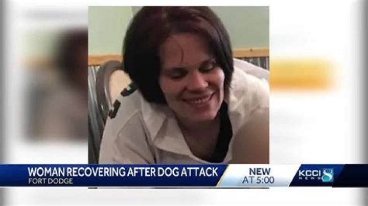 Bravery And Resilience: The Story Of An Iowa Woman Attacked By 3 Pitbulls