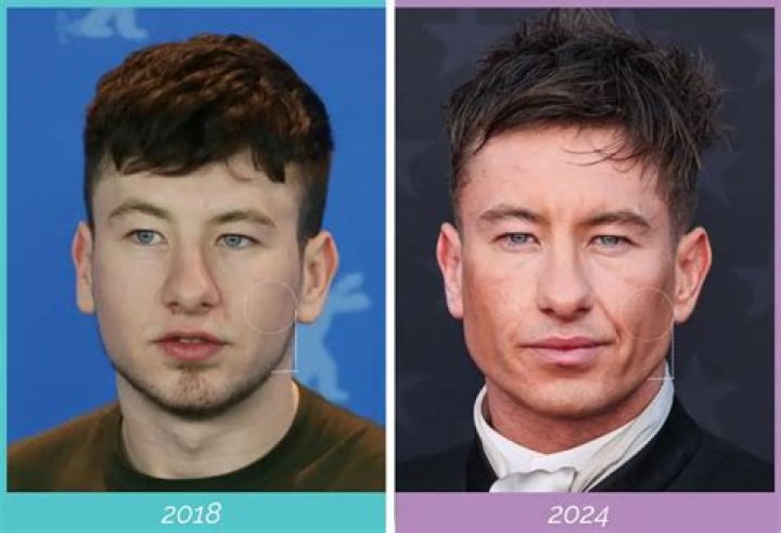 Is Barry Keogan Asian: The Truth Behind The Speculation
