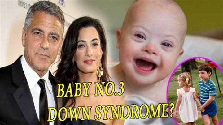 Exploring The Truth: Is George Clooney's Child Have Down Syndrome?
