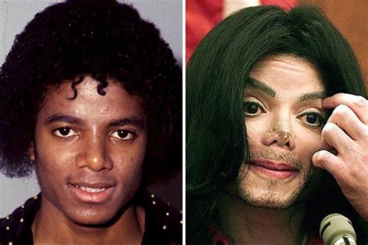 Unveiling The Jackson Family Plastic Surgery Journey
