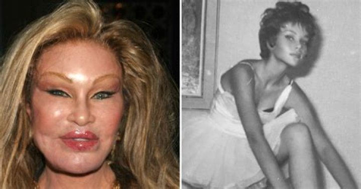 Jocelyn Wildenstein posts unrecognizable throwback photo as she hits out at plastic surgery rumors