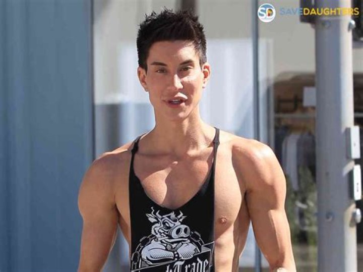 Justin Jedlica: The Transformation Journey Of 2024